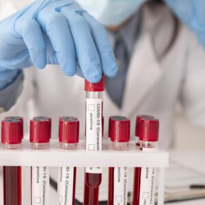 Blood Test (Essential)