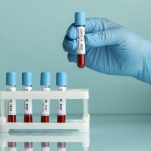 Super Premium (Blood Test) - 87 Test